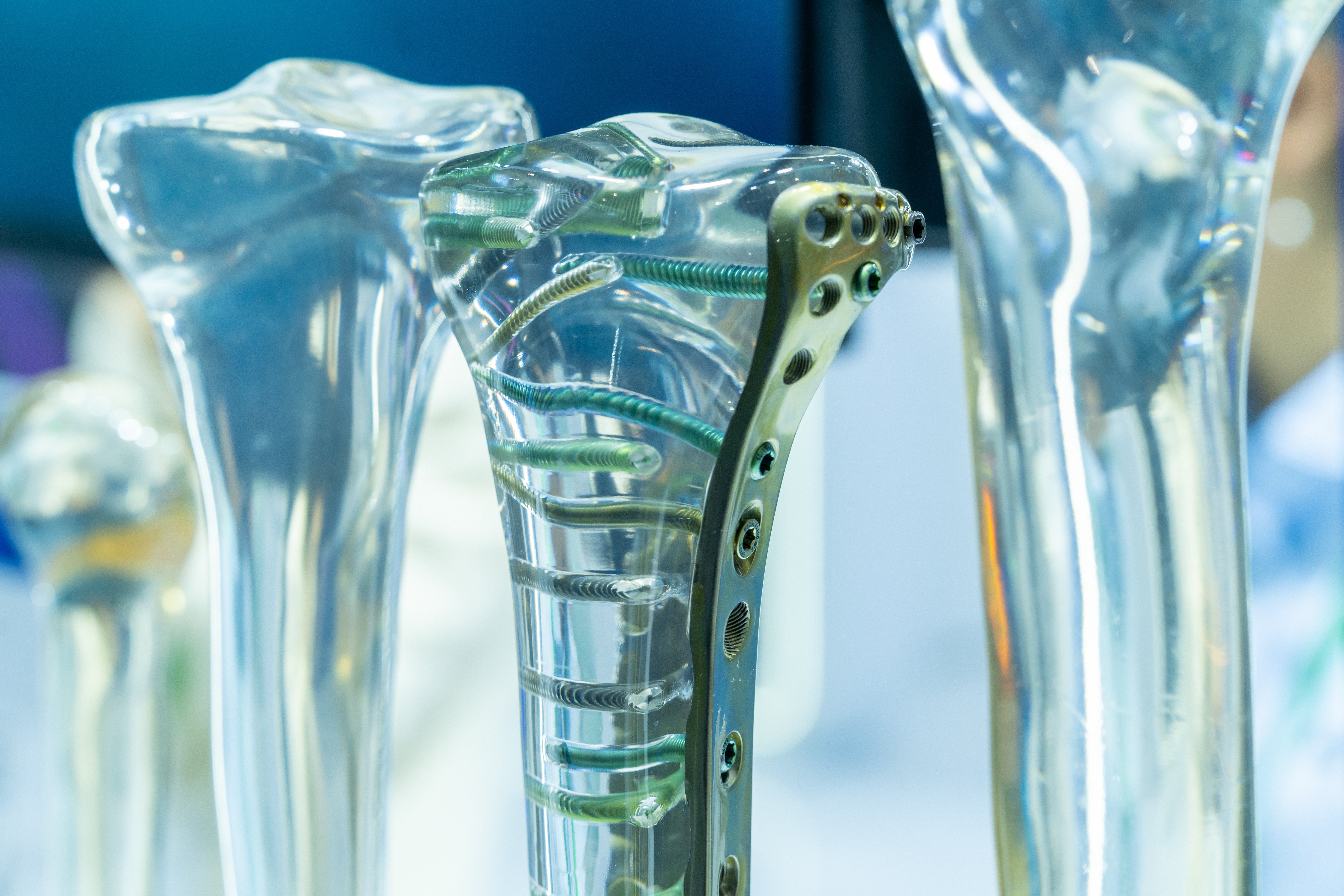 Orthopedic implant