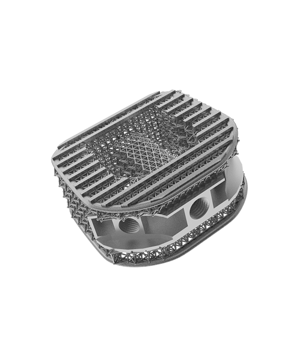 Additive Manufacturing - Medical Spinal Cage