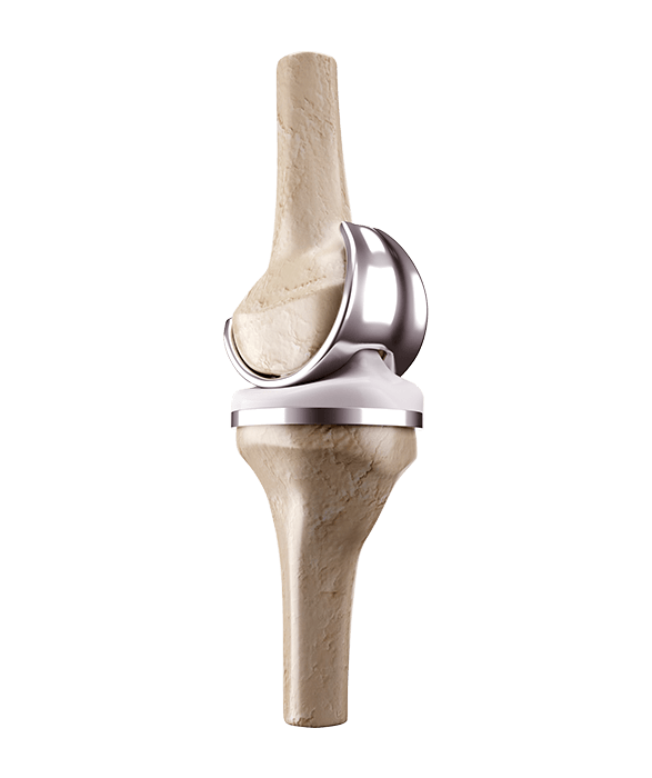 Additive Manufacturing - Medical Orthopedic Devices